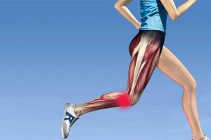سندروم پای بیقرار Restless legs syndrome